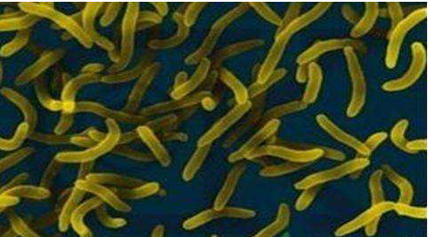 微生物菌劑好？好在哪里您知道嗎？